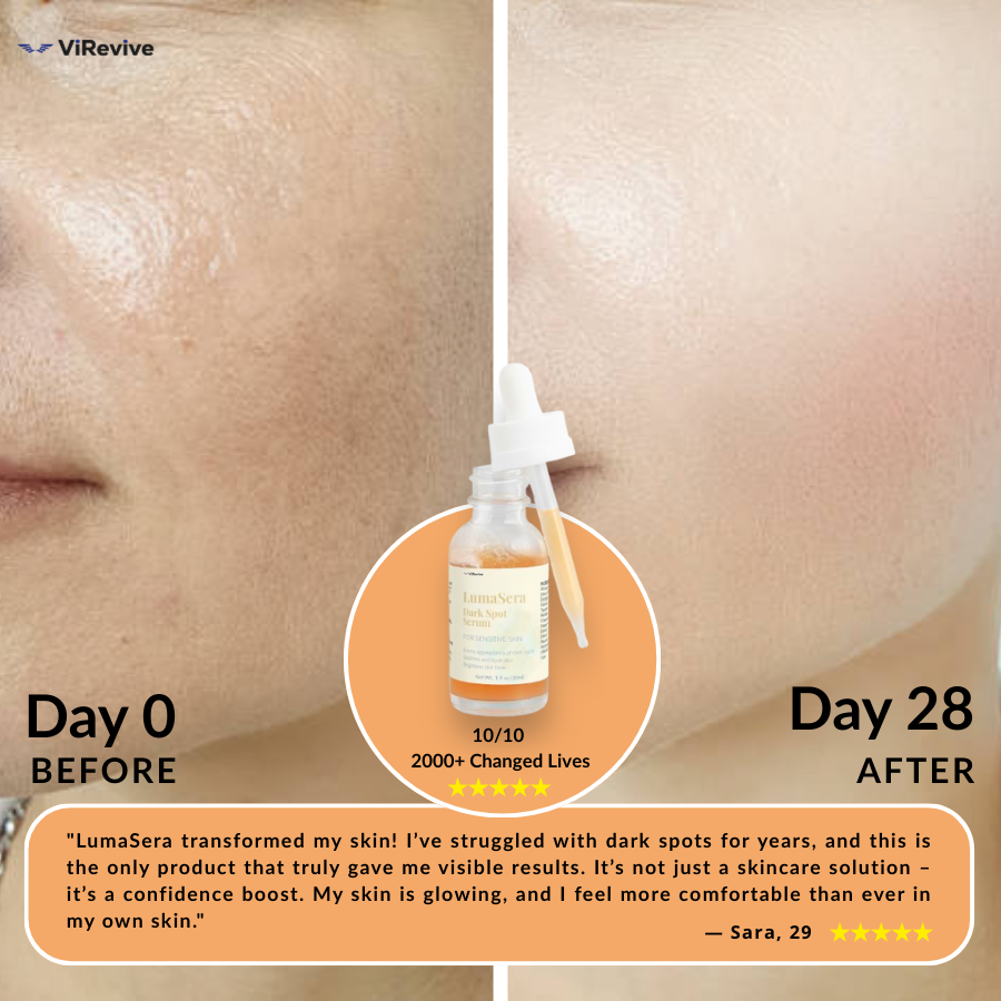 LumaSera® Dark Spot Serum for Sensitive Skin